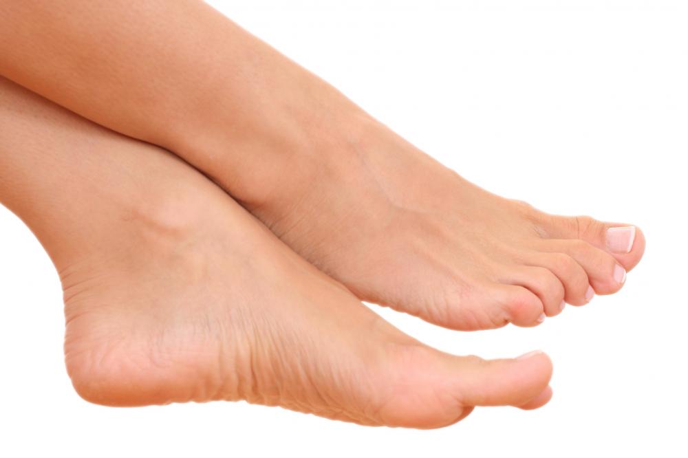 Frugal Home Remedies for Cracked Heels Frugal Home Remedies for Cracked Heels