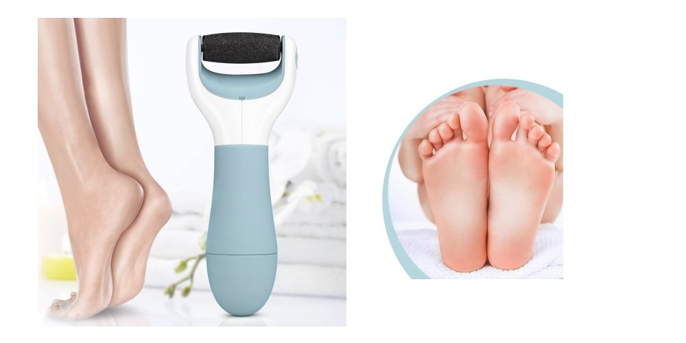 Magicfly Electric Callus Remover With Replacement Roller—$11.99!