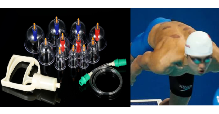 Professional Biomagnetic Cupping Therapy Set Only $10.98 Shipped!