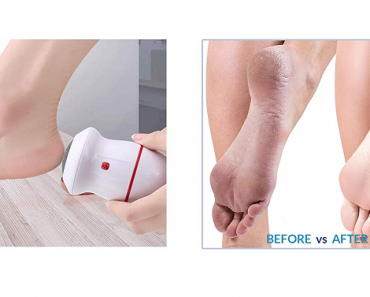 Portable Electric Adsorption Foot Grinder Only $9.29! (Reg $21)